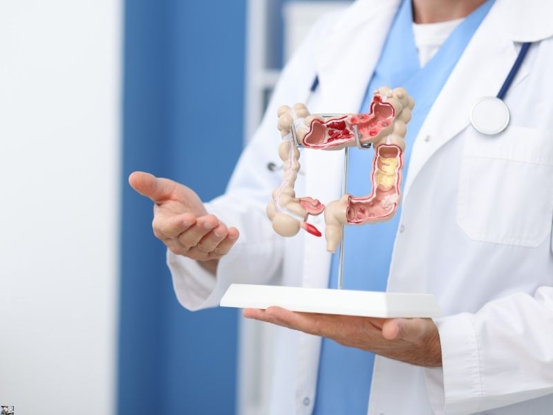 Dokter Lambung Terbaik Di Surabaya, Sembuh dengan Ahlinya